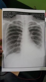 My X-ray image, 9-Nov-2015