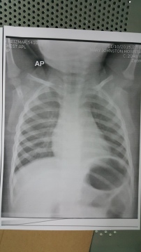 Shanrei's X-ray image (front), 10-Nov-2015